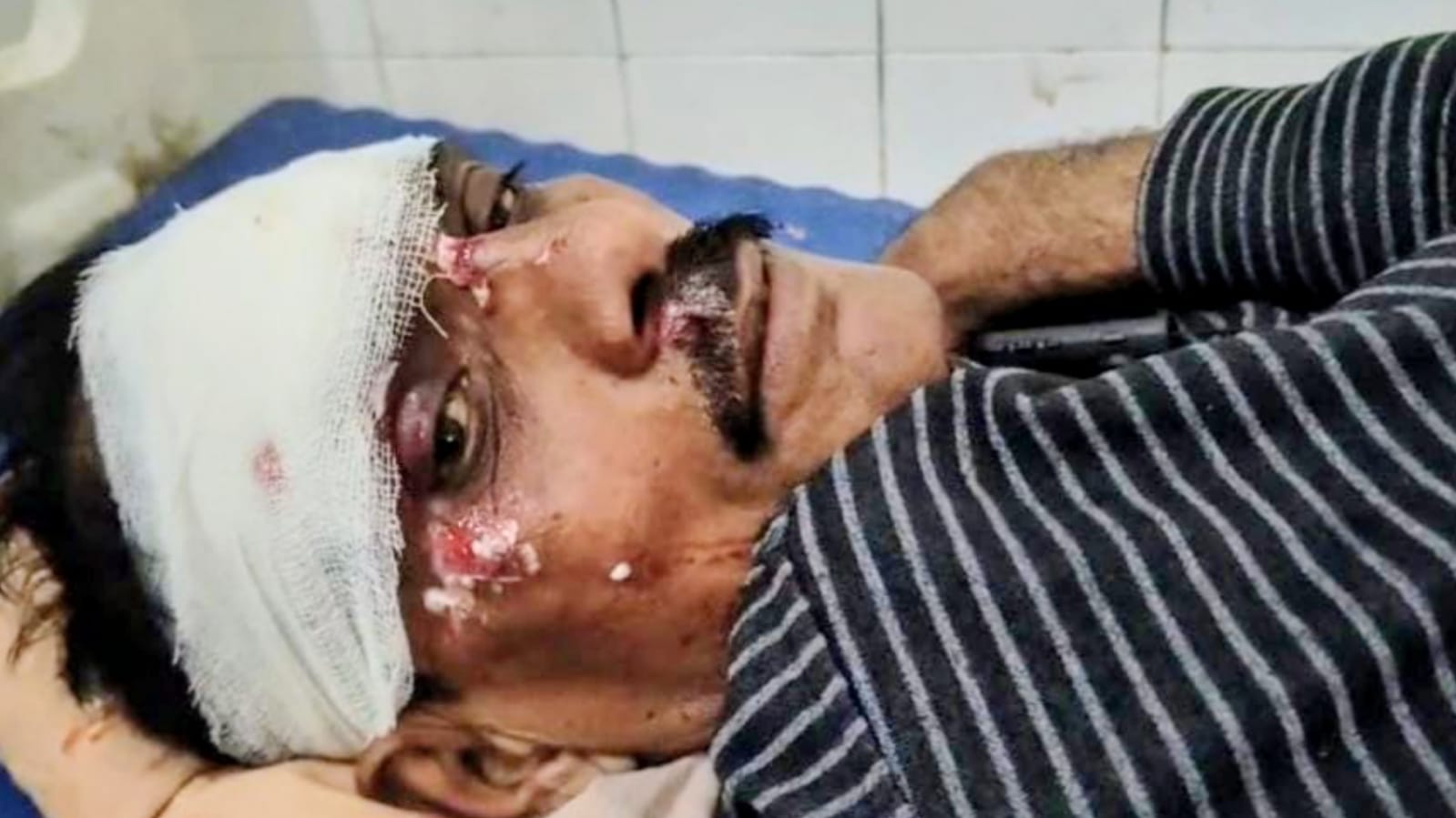 बांदा में पत्रकार इकबाल पर हमला, साजिश के तहत की गई वारदात ?